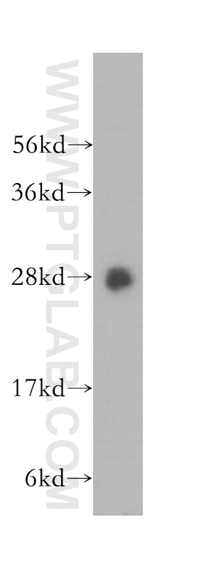Western Blot (WB) analysis of K-562 cells using SPR Polyclonal antibody (16822-1-AP)