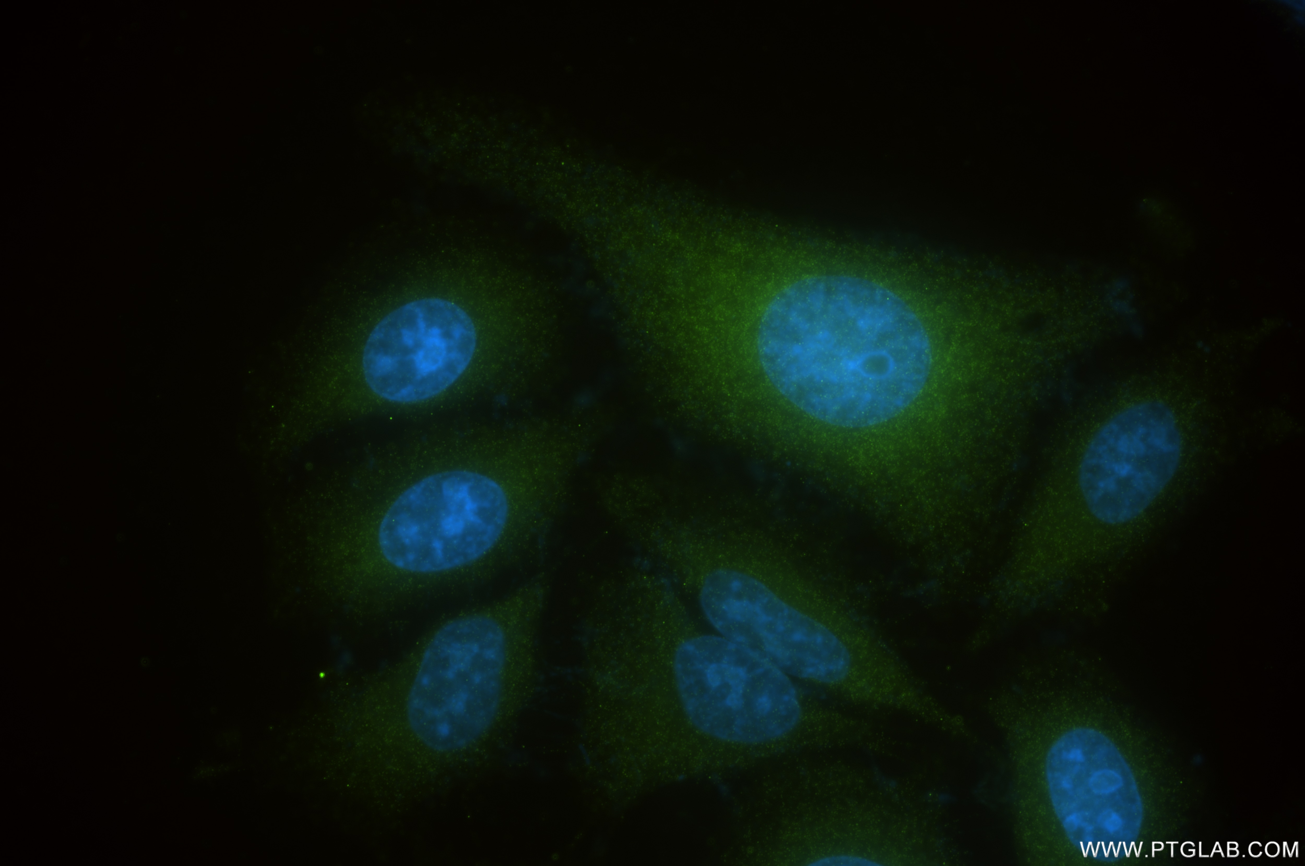 Immunofluorescence (IF) / fluorescent staining of HepG2 cells using SPR Recombinant antibody (85796-5-RR)