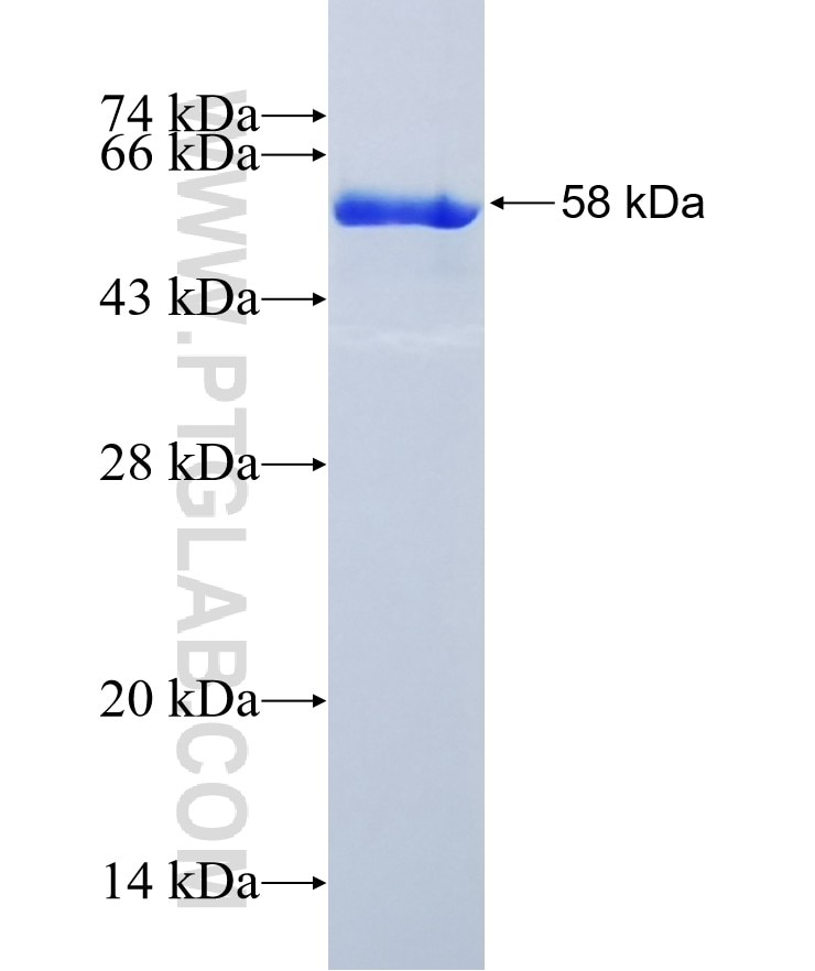 SPR fusion protein Ag10395 SDS-PAGE