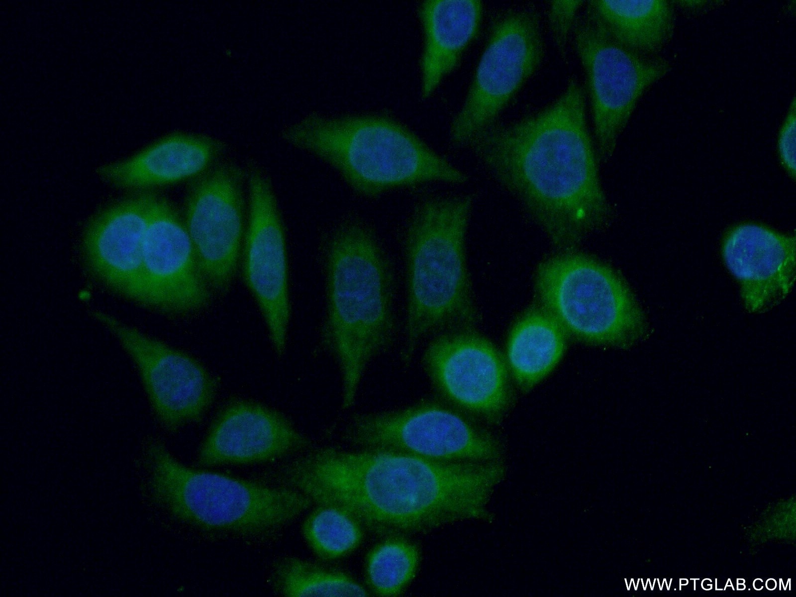 Immunofluorescence (IF) / fluorescent staining of HeLa cells using SPRED2 Polyclonal antibody (24091-1-AP)