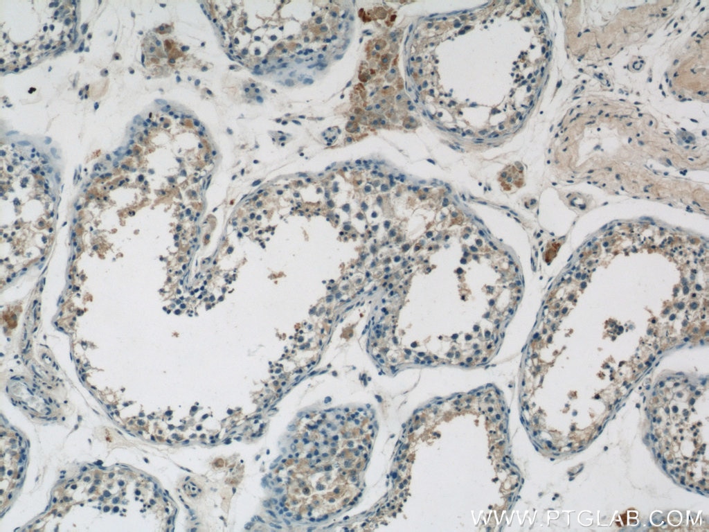 Immunohistochemistry (IHC) staining of human testis tissue using SPRED2 Polyclonal antibody (24091-1-AP)