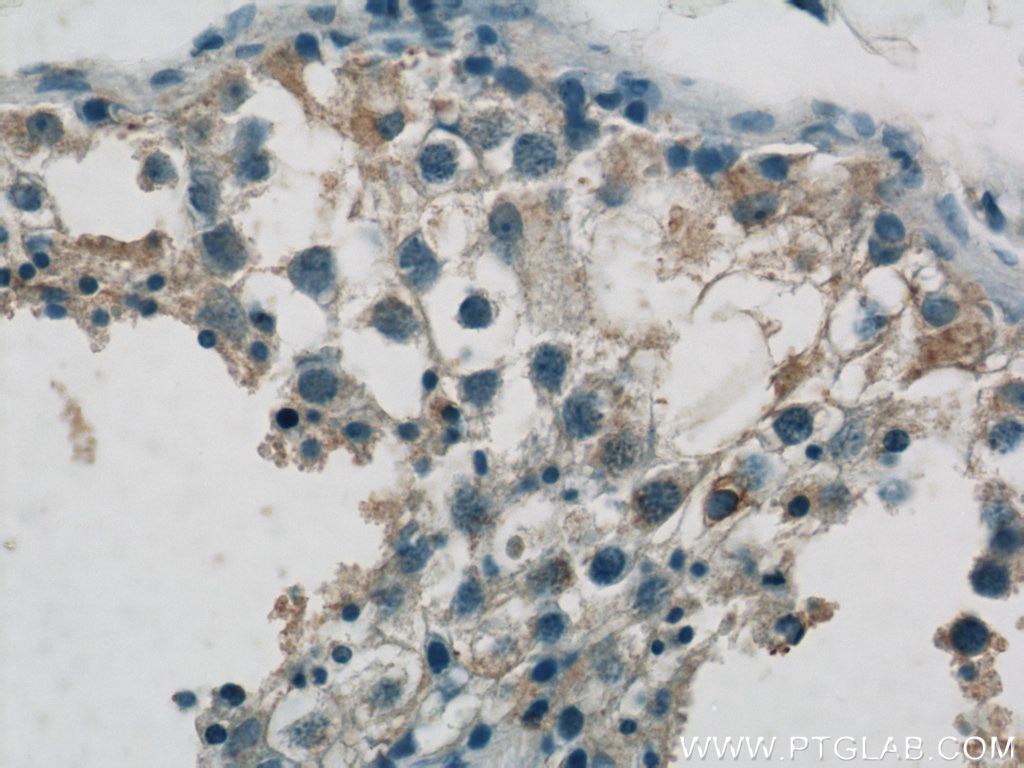 Immunohistochemistry (IHC) staining of human testis tissue using SPRED2 Polyclonal antibody (24091-1-AP)