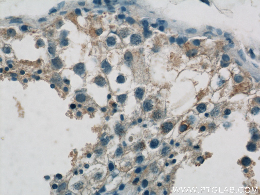 IHC staining of human testis using 24091-1-AP