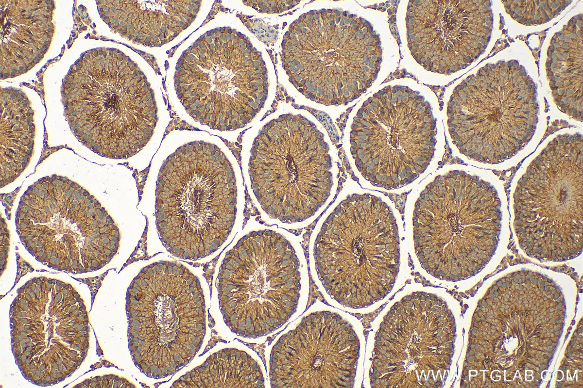 Immunohistochemistry (IHC) staining of rat testis tissue using SPRED2 Polyclonal antibody (24091-1-AP)