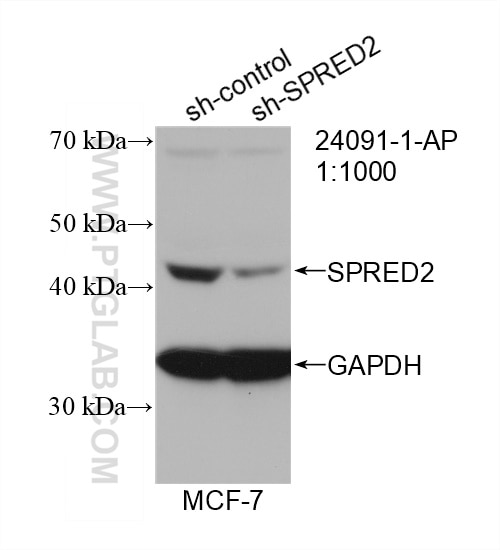 Western Blot (WB) analysis of MCF-7 cells using SPRED2 Polyclonal antibody (24091-1-AP)