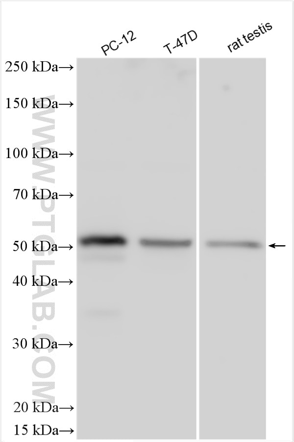 Western Blot (WB) analysis of various lysates using SPRED2 Polyclonal antibody (24091-1-AP)