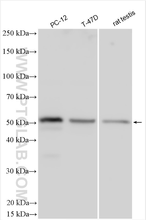 Western Blot (WB) analysis of various lysates using SPRED2 Polyclonal antibody (24091-1-AP)