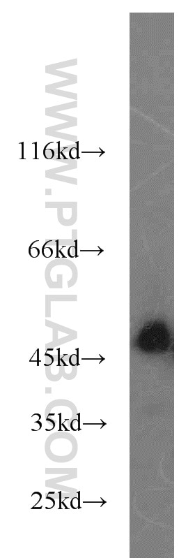 Western Blot (WB) analysis of mouse brain tissue using SPRED2 Polyclonal antibody (24091-1-AP)