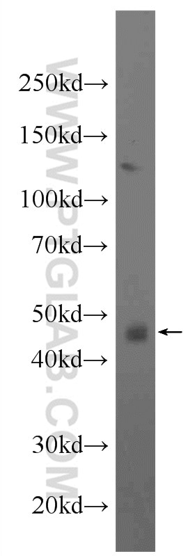 Western Blot (WB) analysis of rat brain tissue using SPRED2 Polyclonal antibody (24091-1-AP)