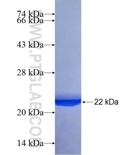 SPRED2 fusion protein Ag21359 SDS-PAGE