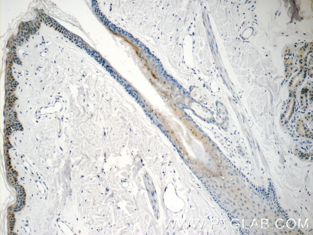 Immunohistochemistry (IHC) staining of human skin tissue using SPRR1B Polyclonal antibody (11959-1-AP)