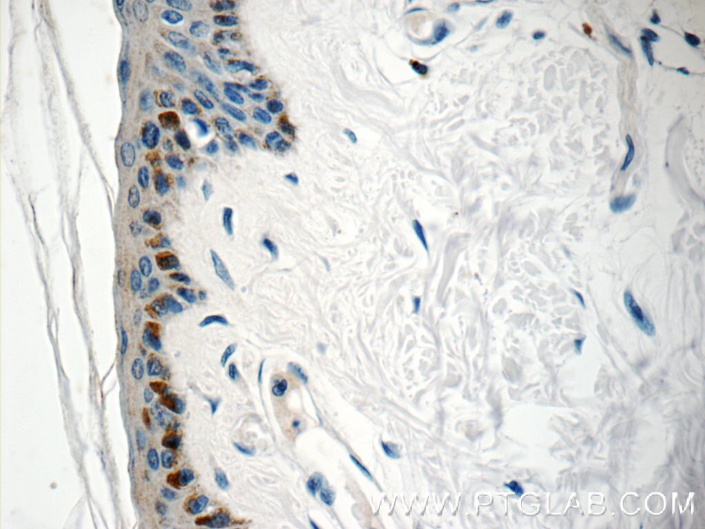 Immunohistochemistry (IHC) staining of human skin tissue using SPRR1B Polyclonal antibody (11959-1-AP)