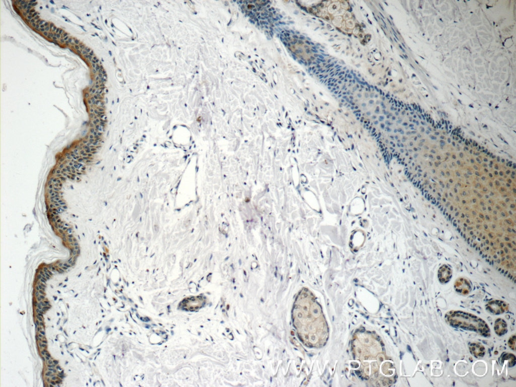 Immunohistochemistry (IHC) staining of human skin tissue using SPRR1B Polyclonal antibody (11959-1-AP)