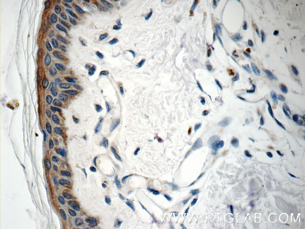 IHC staining of human skin using 11959-1-AP