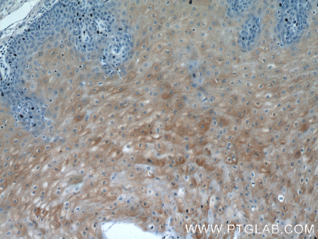 Immunohistochemistry (IHC) staining of human oesophagus tissue using SPRR2D Polyclonal antibody (23046-1-AP)