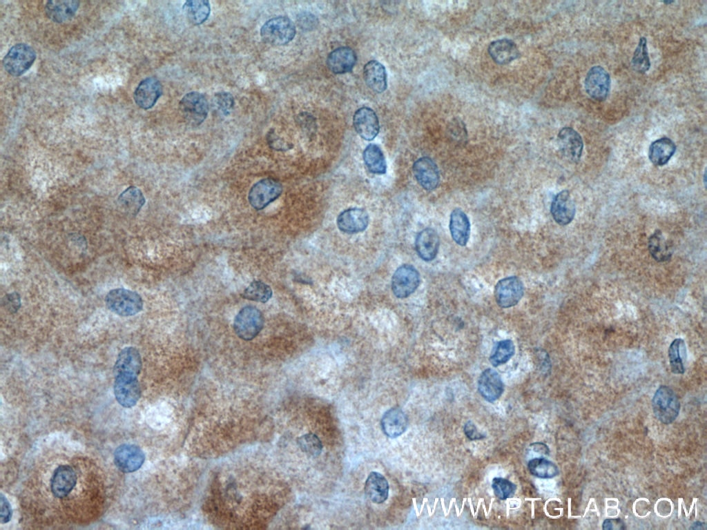 Immunohistochemistry (IHC) staining of human oesophagus tissue using SPRR2D Polyclonal antibody (23046-1-AP)