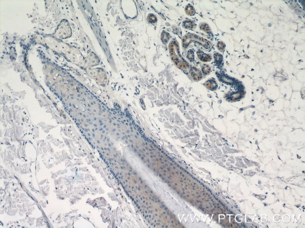 Immunohistochemistry (IHC) staining of human skin tissue using SPRR2D Polyclonal antibody (23046-1-AP)