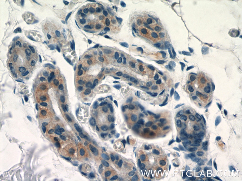 Immunohistochemistry (IHC) staining of human skin tissue using SPRR2D Polyclonal antibody (23046-1-AP)