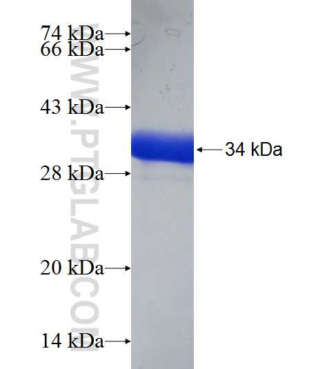 SPRR2F fusion protein Ag20323 SDS-PAGE