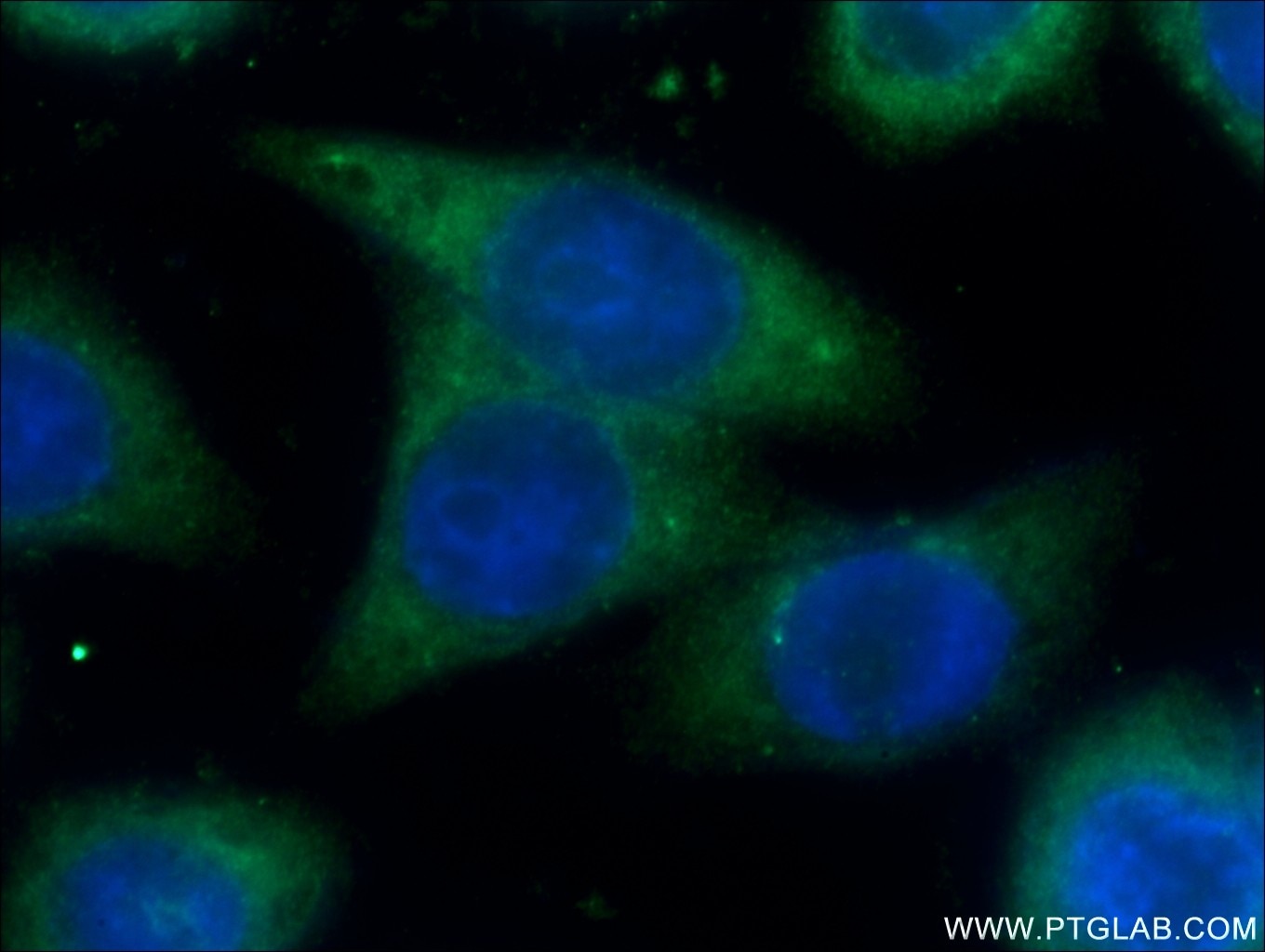 Immunofluorescence (IF) / fluorescent staining of HeLa cells using SPRR3 Polyclonal antibody (11742-1-AP)