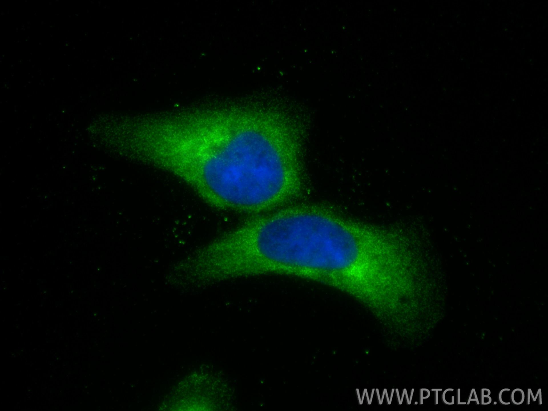 Immunofluorescence (IF) / fluorescent staining of A431 cells using SPRR3 Polyclonal antibody (11742-1-AP)