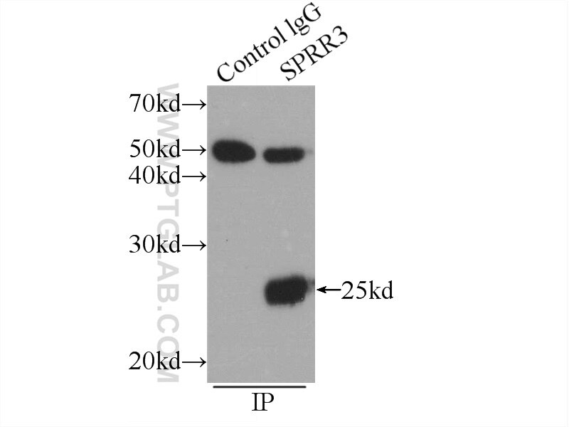 Immunoprecipitation (IP) experiment of COLO 320 cells using SPRR3 Polyclonal antibody (11742-1-AP)