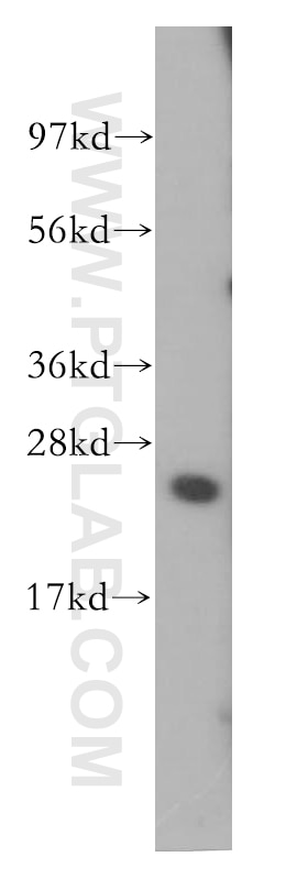 Western Blot (WB) analysis of HeLa cells using SPRR3 Polyclonal antibody (11742-1-AP)