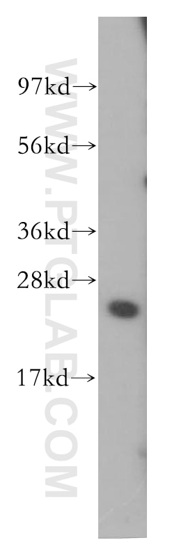 WB analysis of HeLa using 11742-1-AP