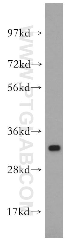 Western Blot (WB) analysis of human liver tissue using SPRR3 Polyclonal antibody (11742-1-AP)