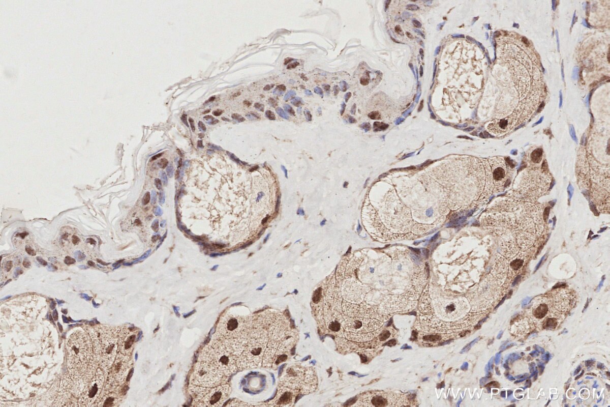 IHC staining of mouse skin using 24850-1-AP (same clone as 24850-1-PBS) Immunohistochemistry (IHC) staining of mouse skin tissue using Spartan Polyclonal antibody (24850-1-AP)