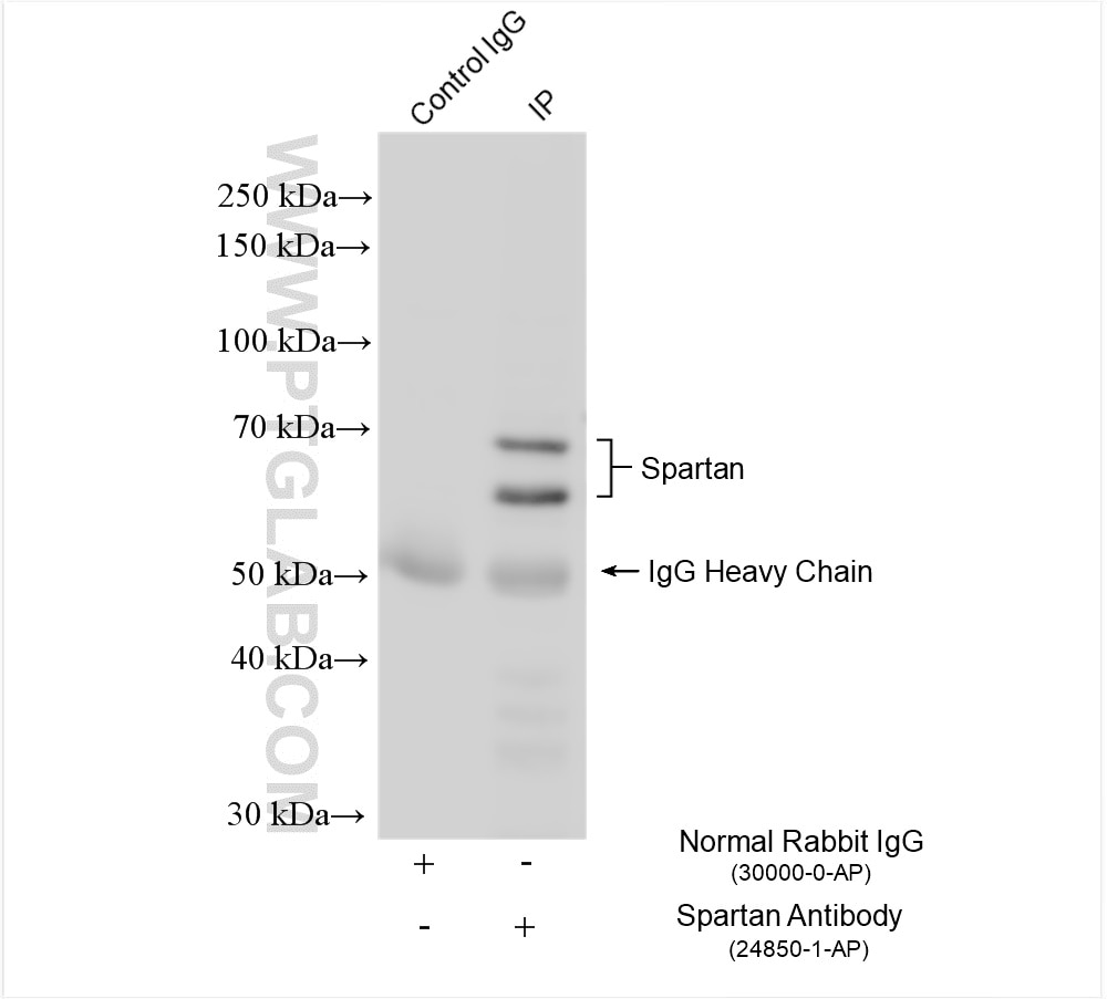 Immunoprecipitation (IP) experiment of HEK-293 cells using Spartan Polyclonal antibody (24850-1-AP)