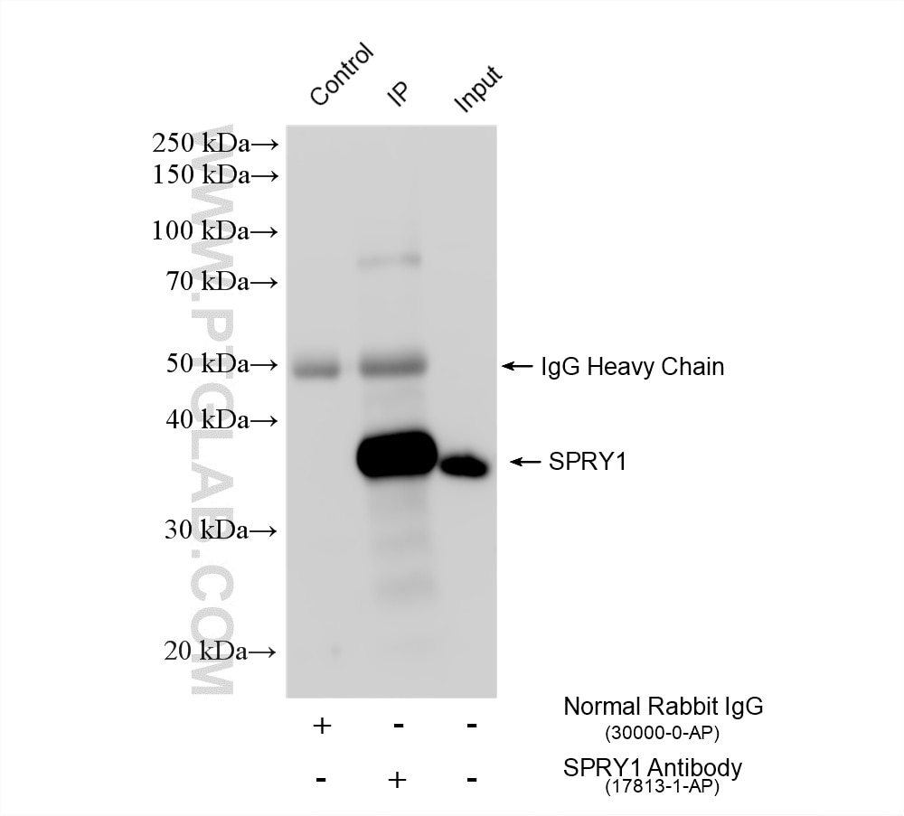 Immunoprecipitation (IP) experiment of A2780 cells using SPRY1 Polyclonal antibody (17813-1-AP)