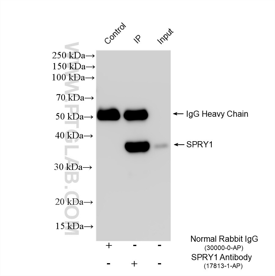 IP result of anti-SPRY1 (IP:17813-1-AP, 4ug; Detection:17813-1-AP 1:3000) with HT-29 cells lysate 1760 ug. Immunoprecipitation (IP) experiment of HT-29 cells using SPRY1 Polyclonal antibody (17813-1-AP)