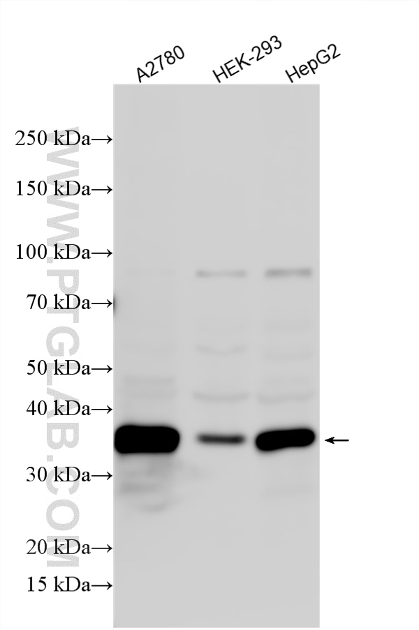 Western Blot (WB) analysis of various lysates using SPRY1 Polyclonal antibody (17813-1-AP)