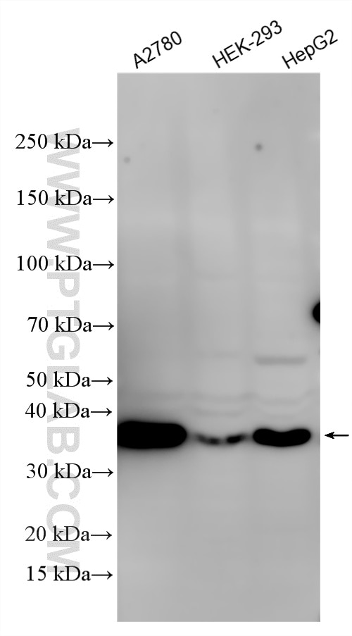 Western Blot (WB) analysis of various lysates using SPRY1 Polyclonal antibody (17813-1-AP)