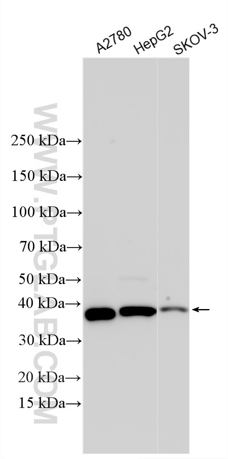 Western Blot (WB) analysis of various lysates using SPRY1 Polyclonal antibody (17813-1-AP)
