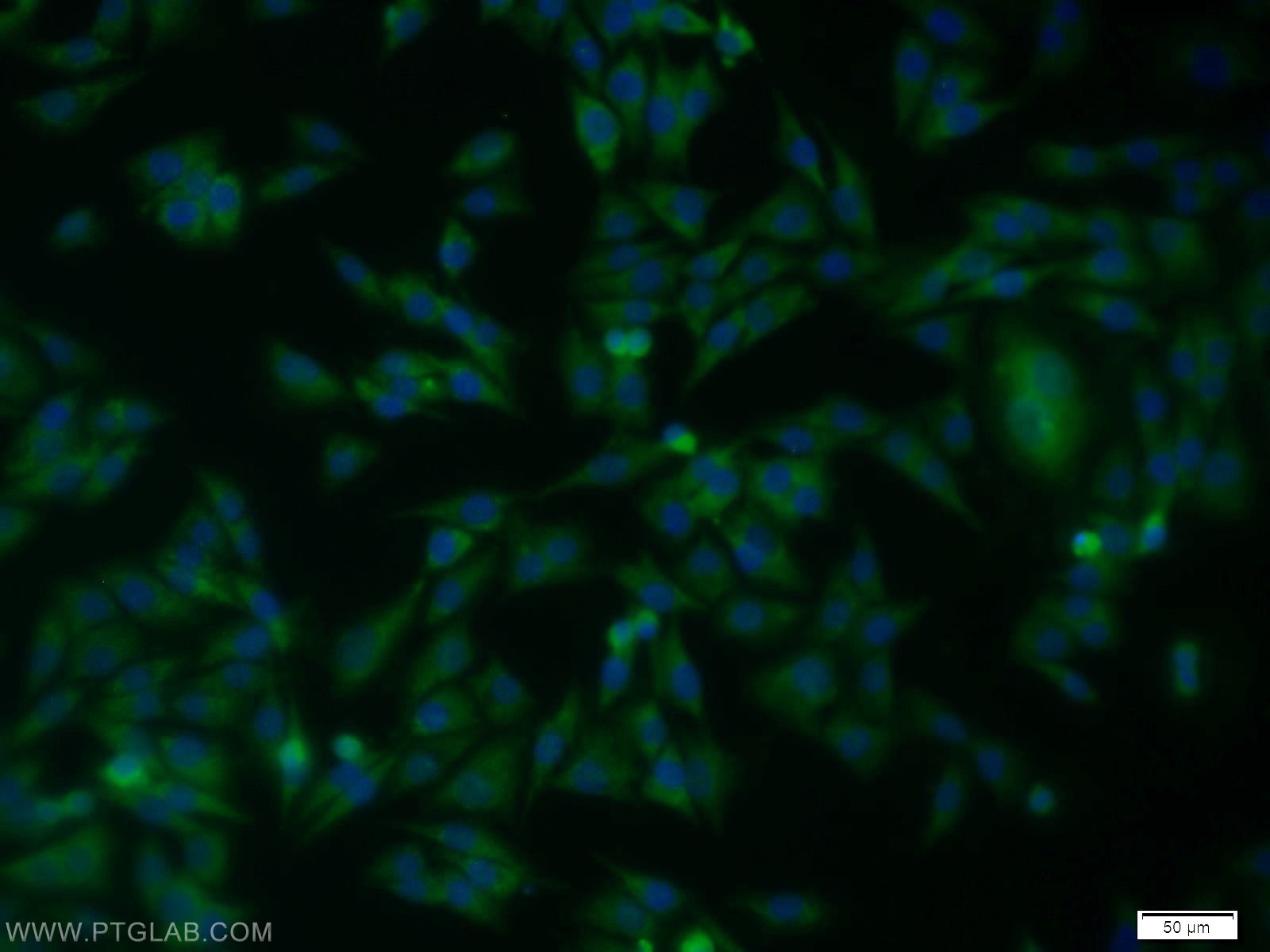 Immunofluorescence (IF) / fluorescent staining of A375 cells using SPRY2 Polyclonal antibody (11383-1-AP)