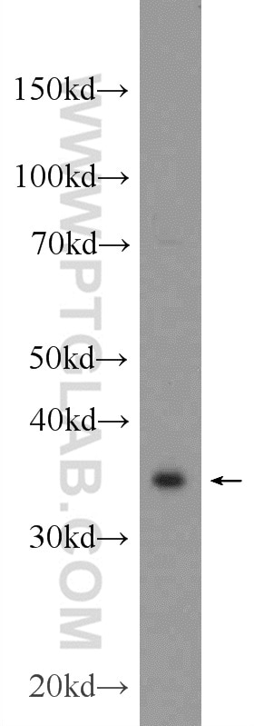 Western Blot (WB) analysis of SW 1990 cells using SPRY2 Polyclonal antibody (11383-1-AP)