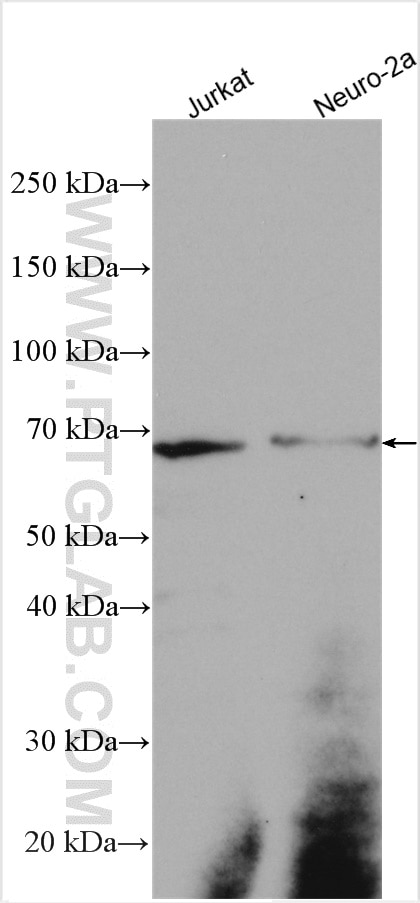 Western Blot (WB) analysis of various lysates using SPRY2 Polyclonal antibody (11383-1-AP)