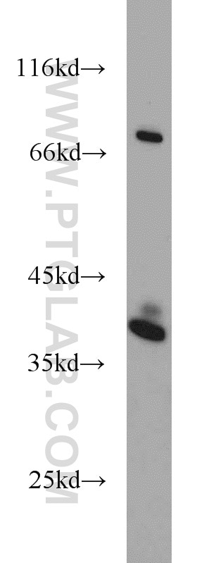 Western Blot (WB) analysis of A375 cells using SPRY2 Polyclonal antibody (11383-1-AP)