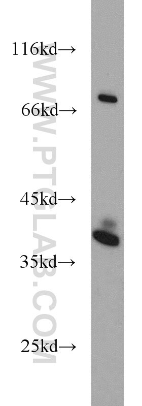 Western Blot (WB) analysis of A375 cells using SPRY2 Polyclonal antibody (11383-1-AP)