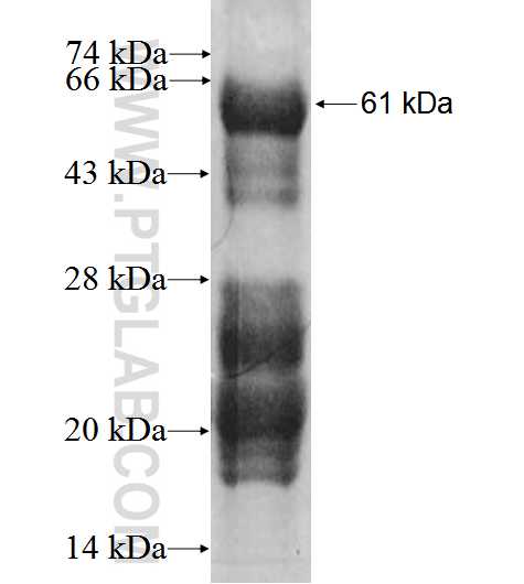 SPRY2 fusion protein Ag1918 SDS-PAGE