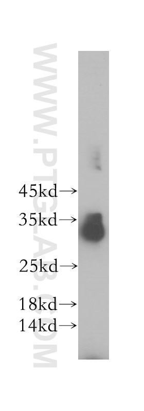 Western Blot (WB) analysis of RAW264.7 using SPRY3 Polyclonal antibody (17932-1-AP)