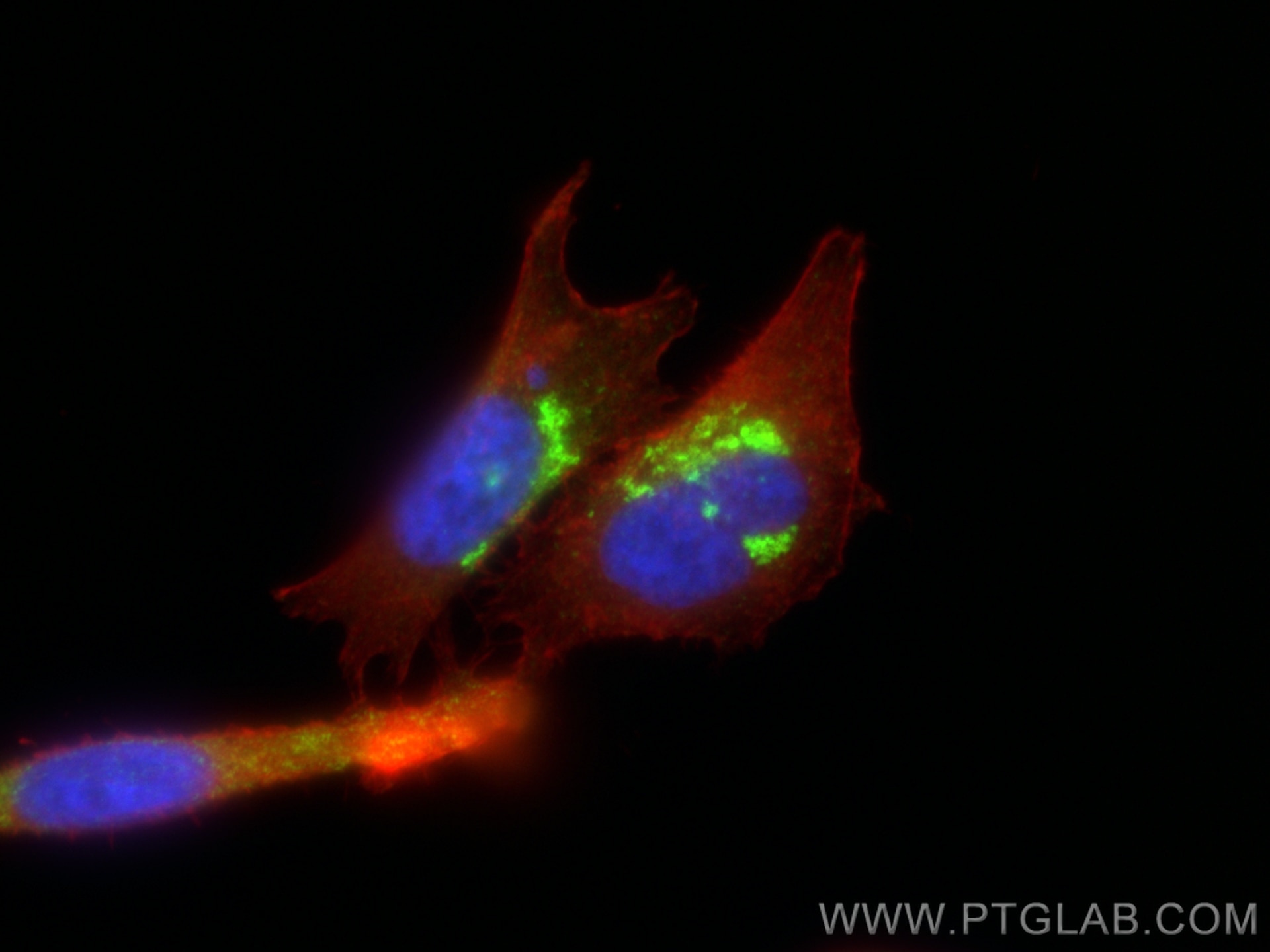 Immunofluorescent analysis of (4% PFA) fixed PC-3 cells using SPRY4 antibody (22765-1-AP) at dilution of 1:200 and Multi-rAb CoraLite ® Plus 488-Goat Anti-Rabbit Recombinant Secondary Antibody (H+L) (RGAR002), CL594-phalloidin (red). Immunofluorescence (IF) / fluorescent staining of PC-3 cells using SPRY4 Polyclonal antibody (22765-1-AP)