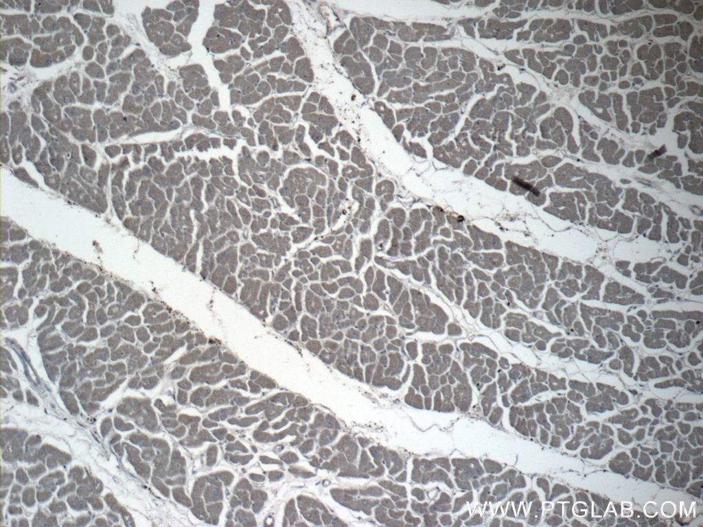 Immunohistochemistry (IHC) staining of human heart tissue using SPRY4 Polyclonal antibody (22765-1-AP)