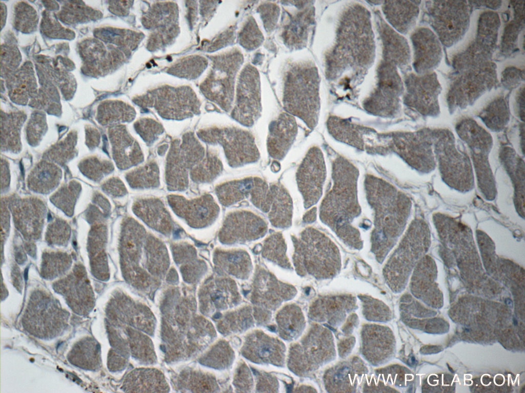 Immunohistochemistry (IHC) staining of human heart tissue using SPRY4 Polyclonal antibody (22765-1-AP)