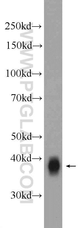 Western Blot (WB) analysis of A375 cells using SPRY4 Polyclonal antibody (22765-1-AP)