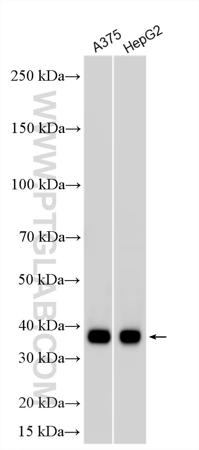 WB analysis using 22765-1-AP Western Blot (WB) analysis of various lysates using SPRY4 Polyclonal antibody (22765-1-AP)