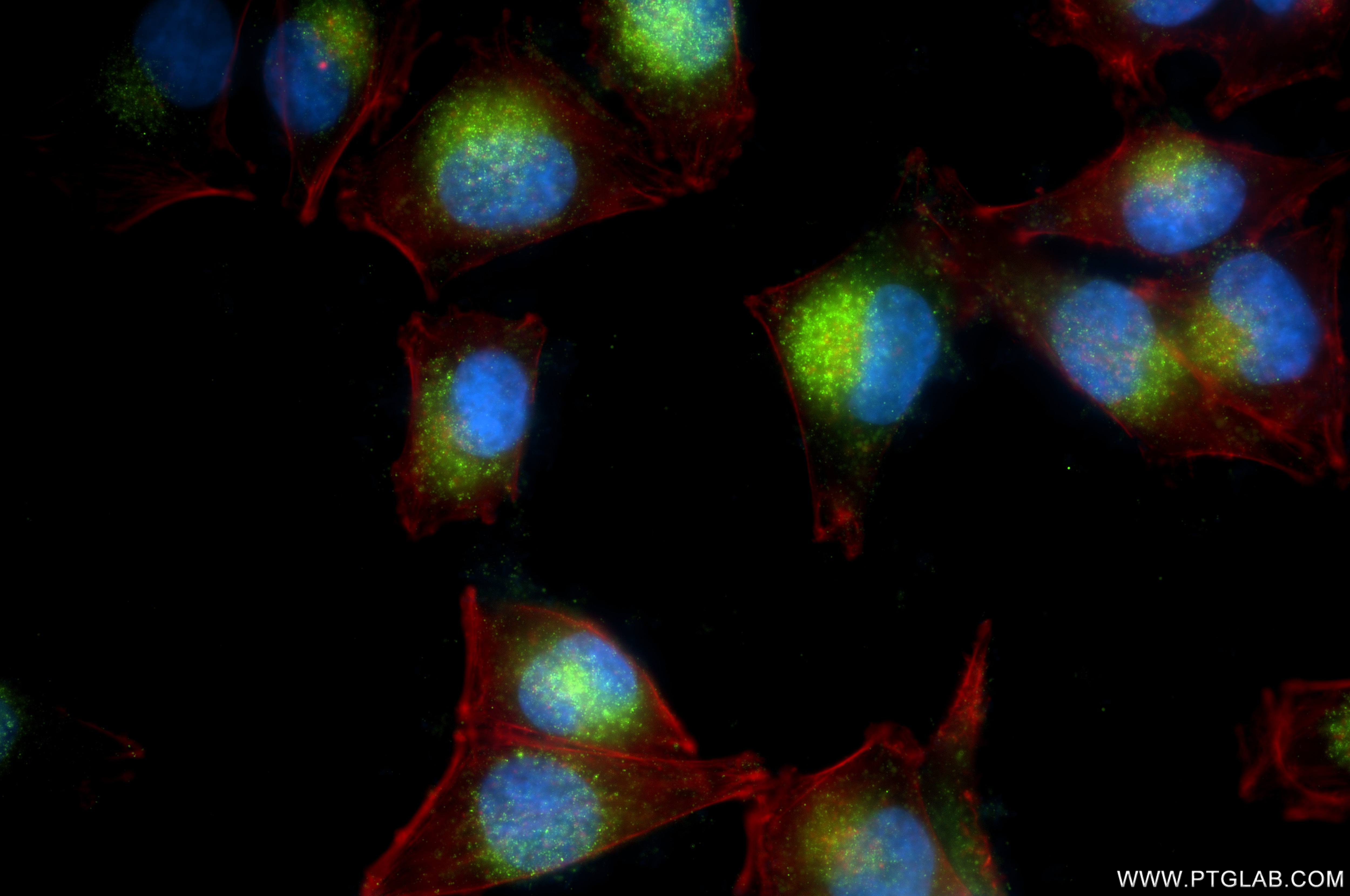 IF Staining of A375 using 87666-1-RR (same clone as 87666-1-PBS) Immunofluorescence (IF) / fluorescent staining of A375 cells using SPRY4 Recombinant monoclonal antibody (87666-1-RR)