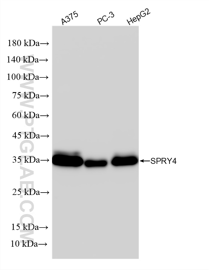 WB analysis using 87666-1-RR (same clone as 87666-1-PBS) Western Blot (WB) analysis of various lysates using SPRY4 Recombinant monoclonal antibody (87666-1-RR)